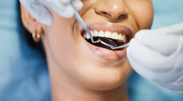Best Broken Tooth Emergency  in Rosedale, LA